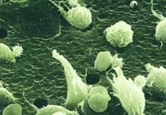 沃特曼/whatman_170607_Nuclepore径迹蚀刻膜_Φ25mm  孔径 0.4μm GOLD  50片/盒