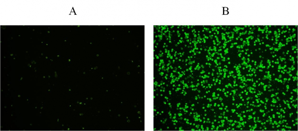 Cell Meter 磷脂酰丝氨酸凋亡检测试剂盒 绿色荧光,适合微孔板检测     货号22791