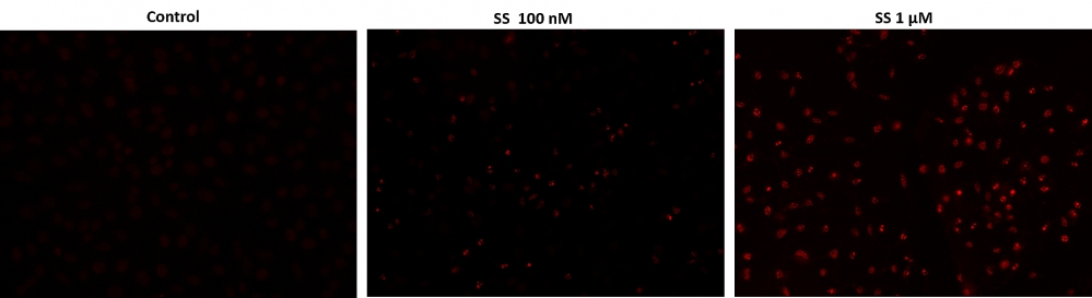 Cell Meter TUNEL凋亡检测试剂盒 红色荧光    货号22844