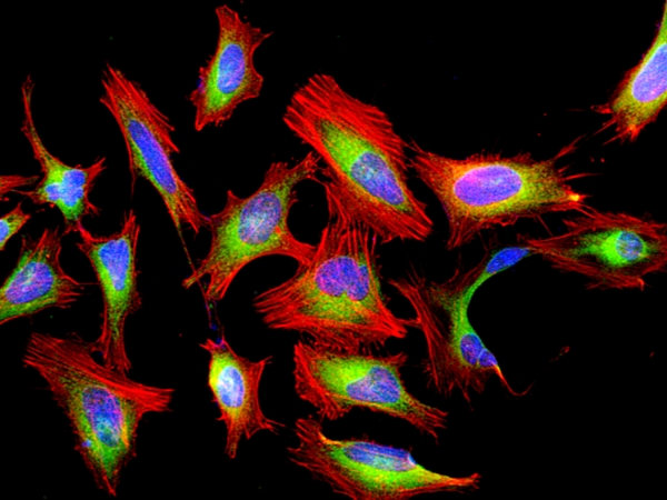 Cell Navigator F-肌动蛋白(F-Actin)标记试剂盒 红色荧光 货号22664