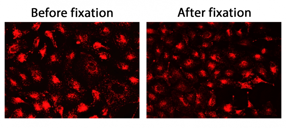 CytoFix 溶酶体红色探针    货号23210