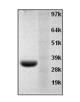 重组Annexin V 蛋白 CAS 136107-94-3    货号20015